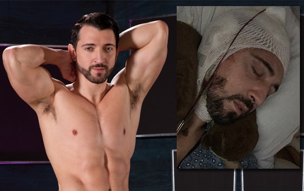 Ator pornô gay Jimmy Durano passa por cirurgia