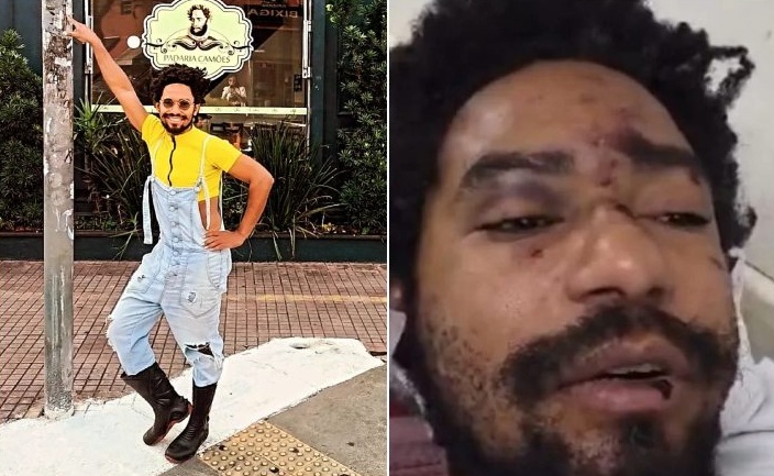 Ator Diego Summer sofre ataque homofóbico no Cambuci, em São Paulo
