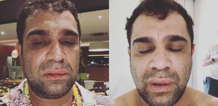 Comediante gay Evandro Santo é alvo de agressão homofóbica em Marília, São Paulo