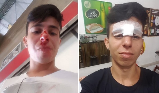 Guilherme Lima: gay é atacado no Terminal São Mateus