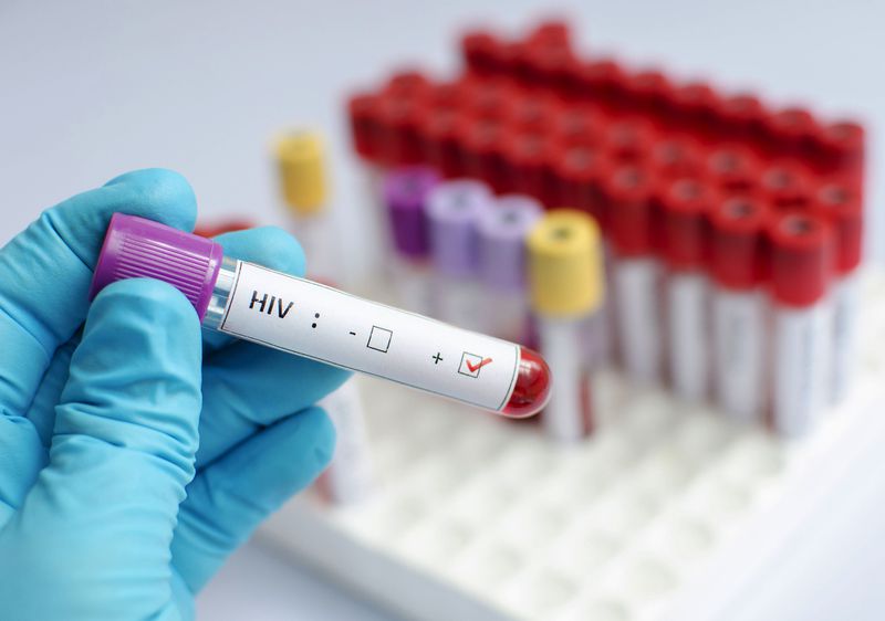 Novas infecções por HIV caem em São Paulo