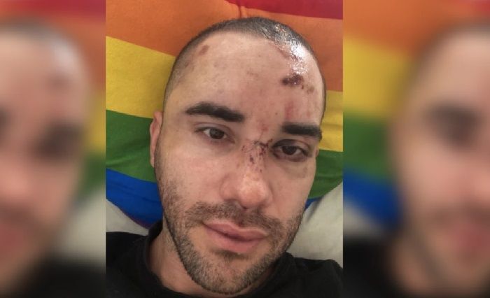 Homofobia: gay apanha após sair de festa LGBT na Barra Funda, em São Paulo