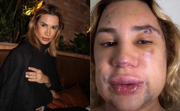 Morre influencer gay Junior Dutra