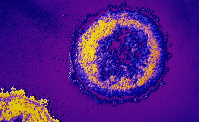 Cientistas descobrem fraqueza do HIV que pode levar a vacina