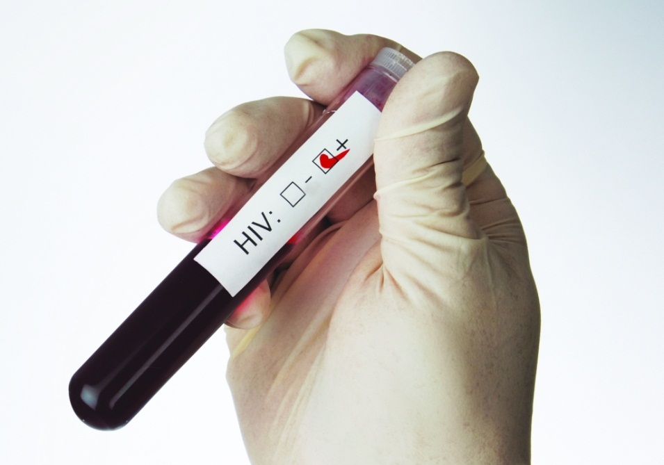 hiv bh gay