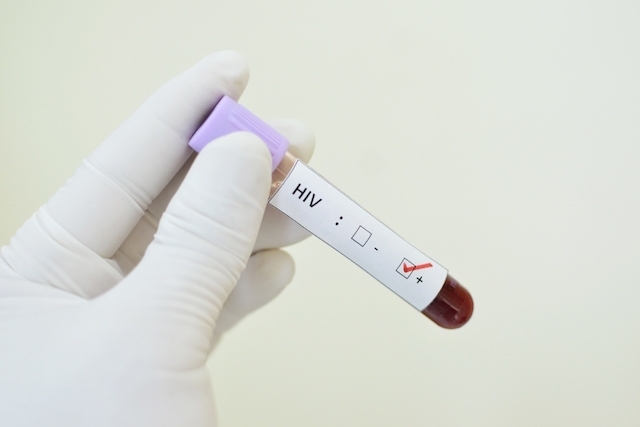Pesquisa revelou índice de infecção pelo HIV em 12 capitais brasileiras