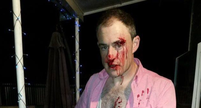 Homem hétero apanha e é chamado de gay por vestir camisa rosa