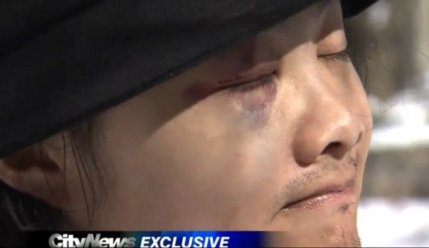 Homem hétero é atacado por acharem que ele é gay no Canadá