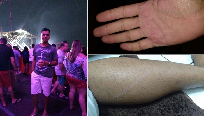 Jovem gay diz ter sido vítima de homofobia ao ser espancado por seguranças em show sertanejo