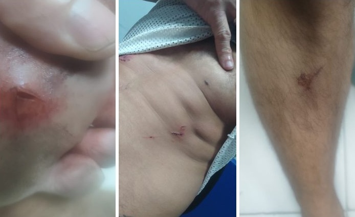 Praeiros Bar: agressão dentro de bar gay