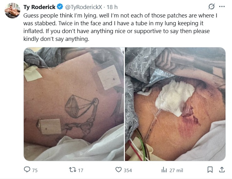 Ty Roderick é esfaqueado: ator de pornô gay