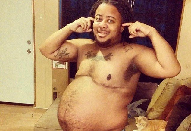Transexual pensou que estivesse gordo e se descobriu grávido
