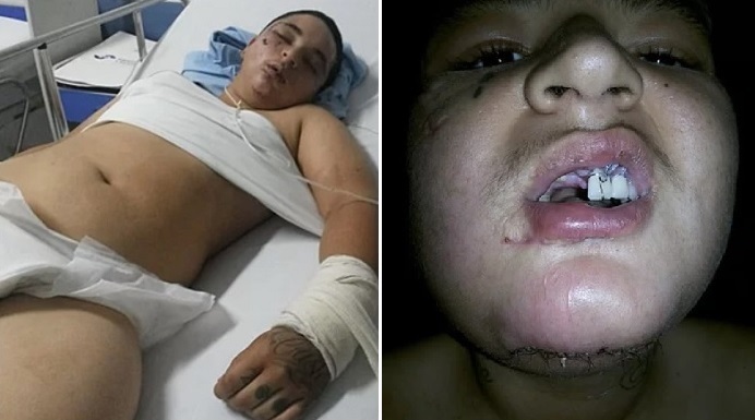 Vaquinha criada por gay arrecada R$ 74 mil para lésbica agredida 
