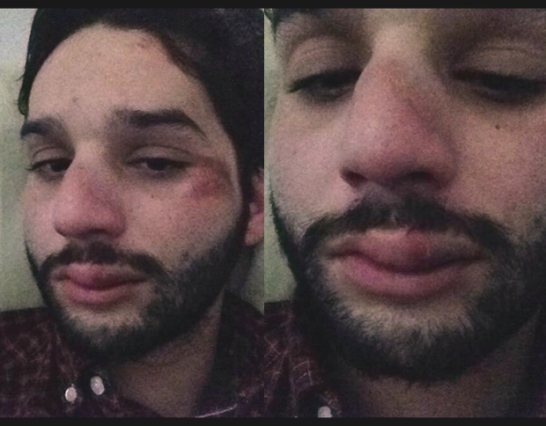 Rapaz sofre ataque na Rua Augusta e acredita ter sido vítima de homofobia